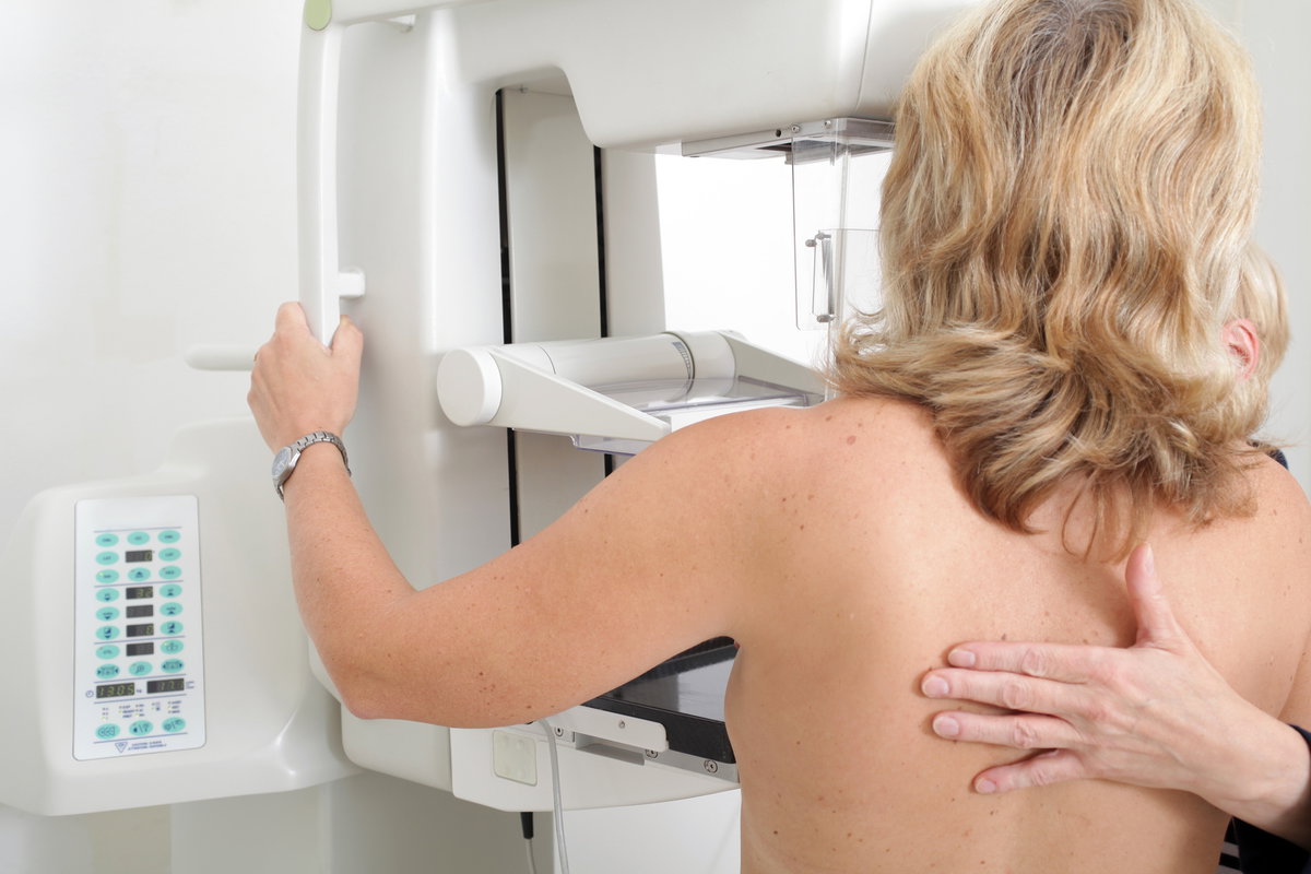 Brustkrebs wird meist bei Mammographie-Untersuchungen entdeckt