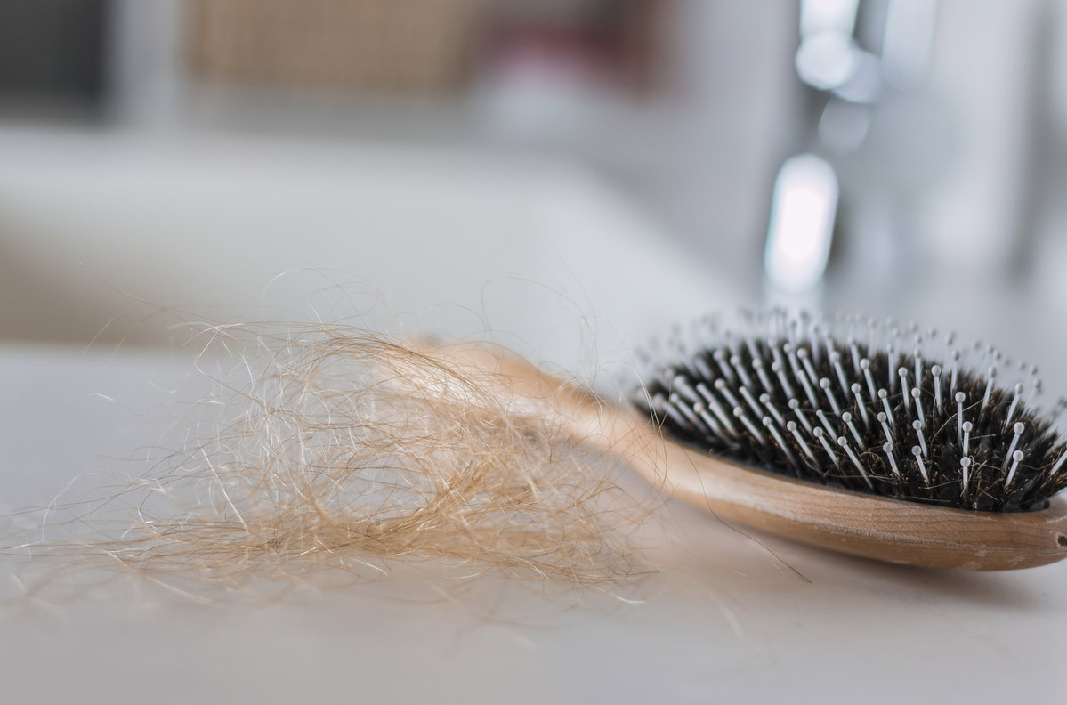 Gehen Sie dem Haarausfall auf den Grund, wenn Sie übermäßig viele Haare ausbürsten