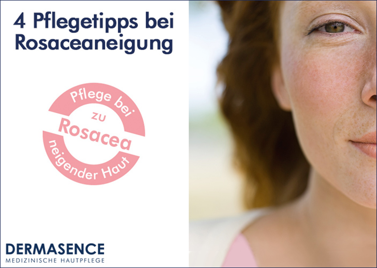 Typische Merkmale für Rosacea sind erweiterte Äderchen und Rötungen im Gesicht. 