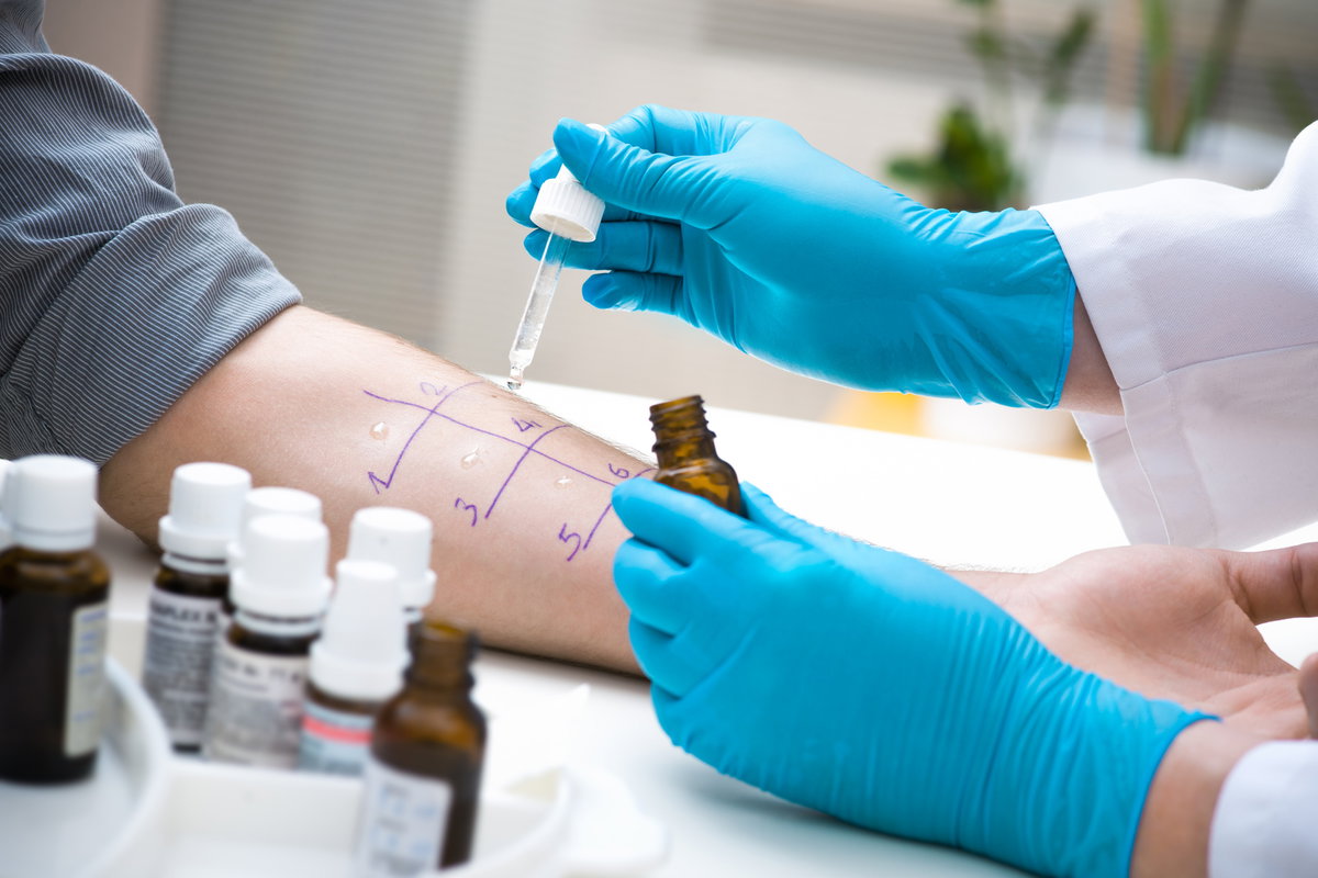 Prick Test beim Arzt