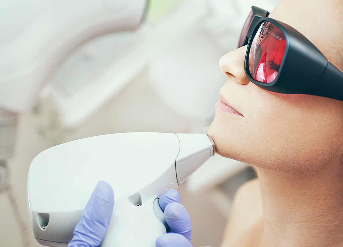 Langfristiger ist die Behandlung der Gesichtsbehaarung mit dem Laser- oder IPL-Gerät.