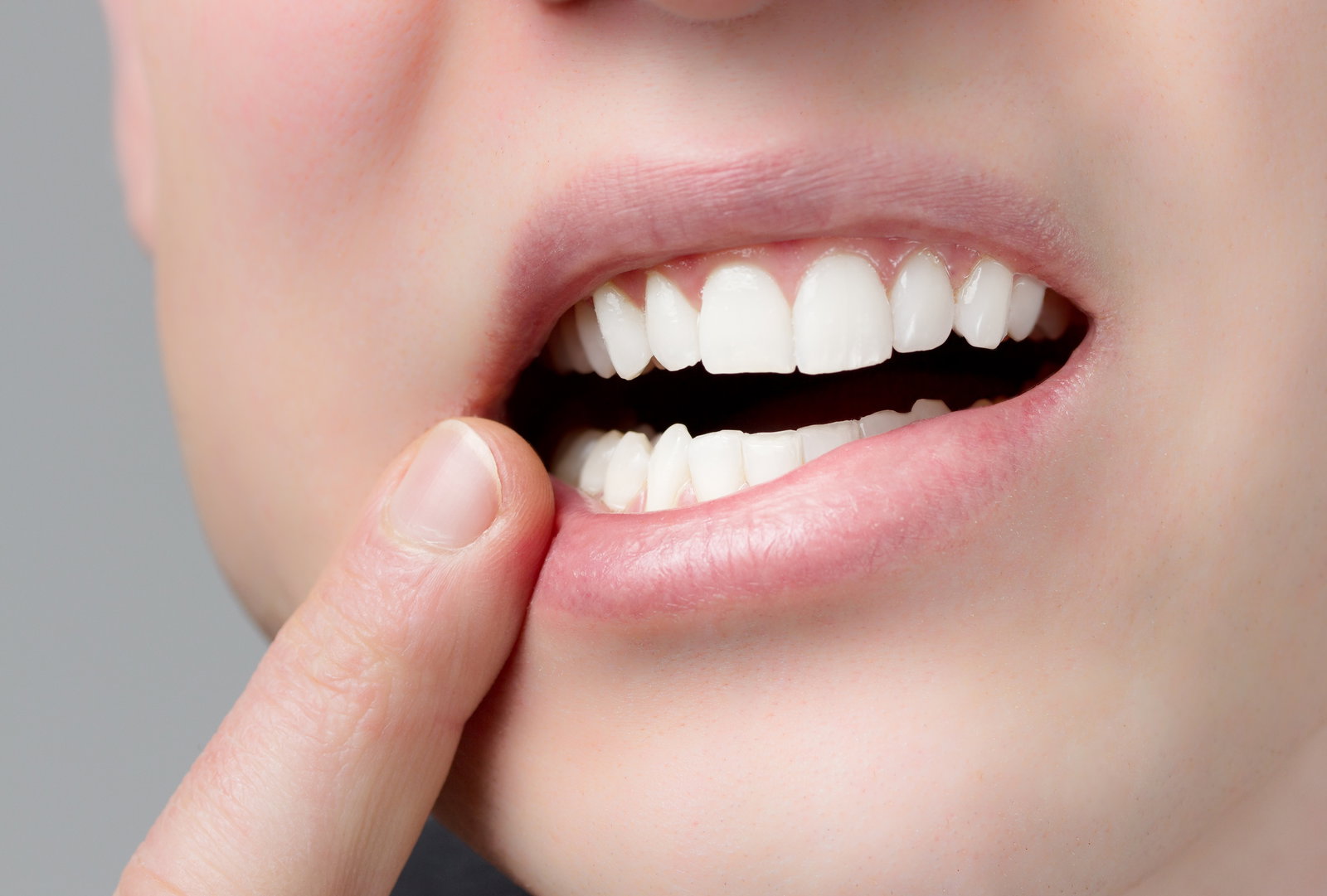 Periodontal disease: prevention is a must! 