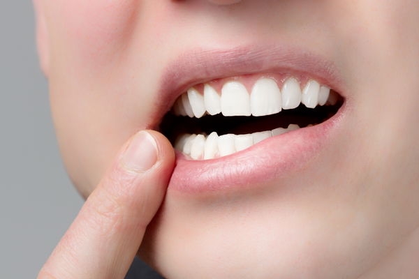 Periodontal disease: prevention is a must!