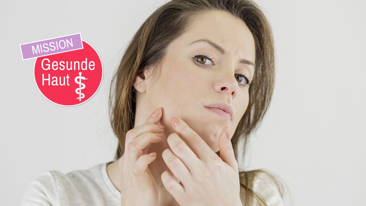 Conseil d'expert : que faire en cas d'acné ? 