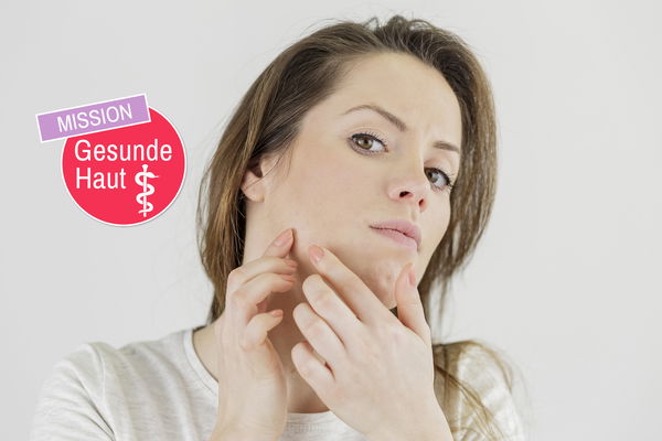 Conseil d'expert : que faire en cas d'acné ?