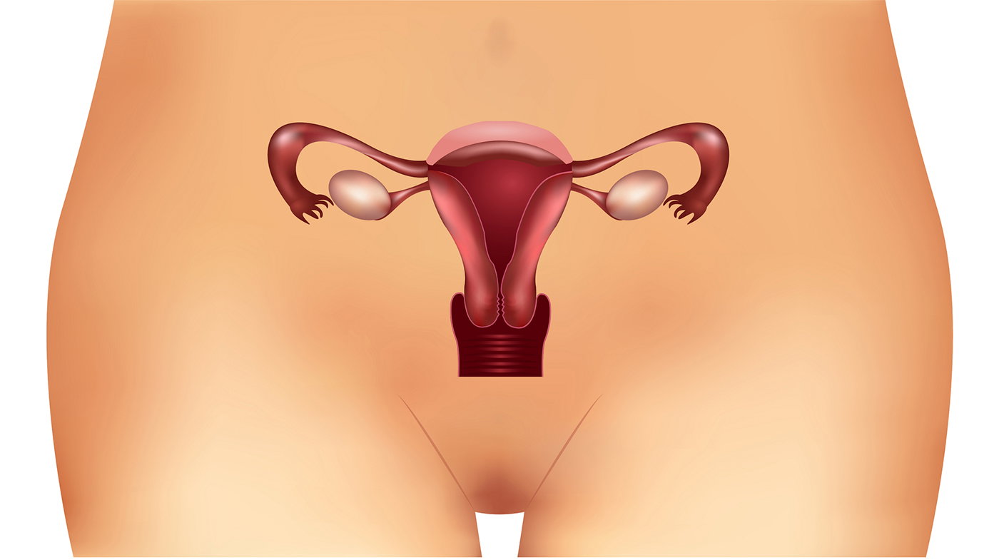 PCO syndrome: symptoms, causes and treatment of the hormonal disorder
