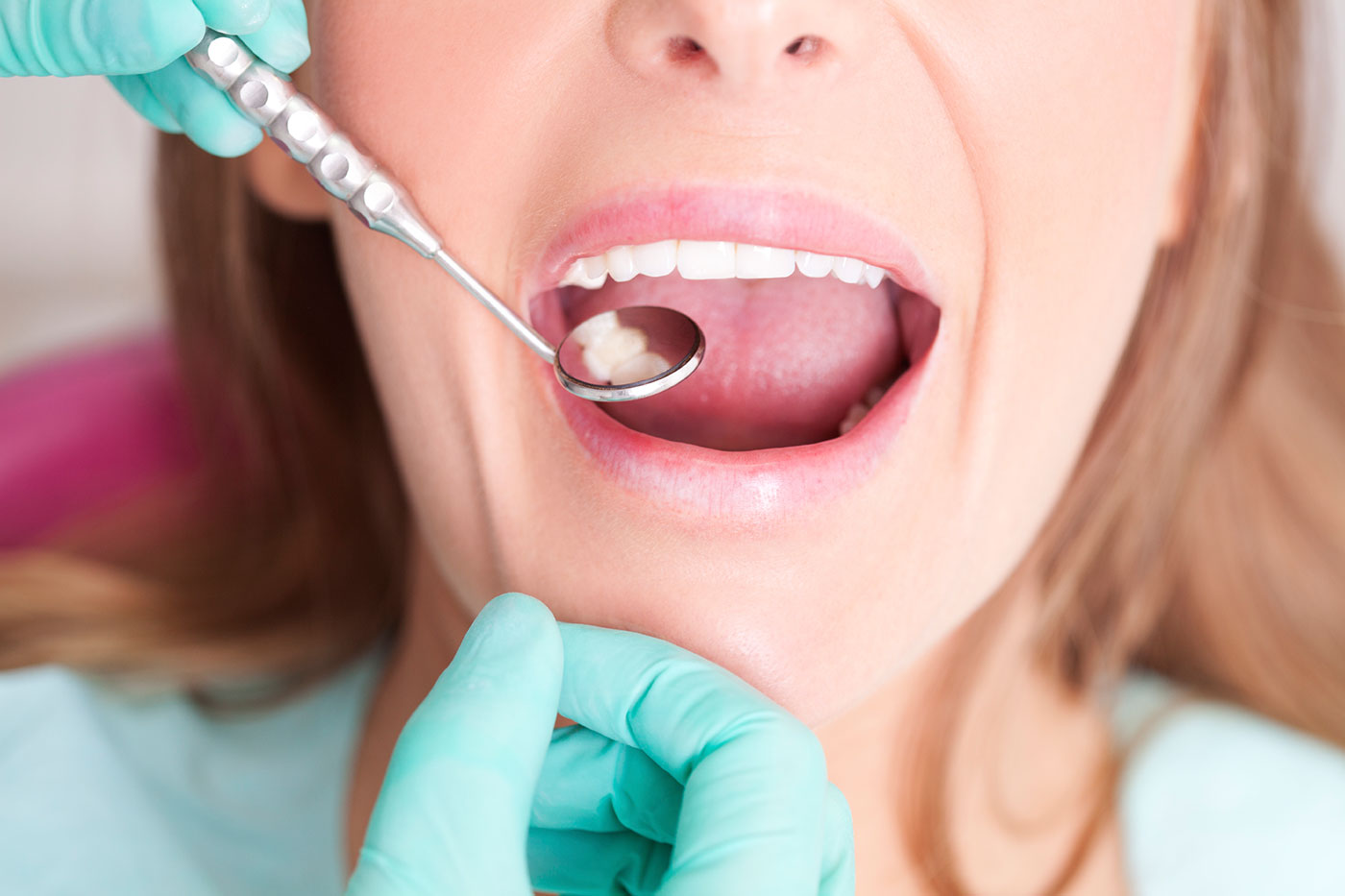 In disrepute: Do I have to replace my amalgam filling? 