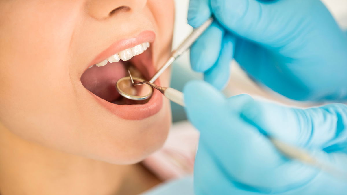 What is periodontitis?
