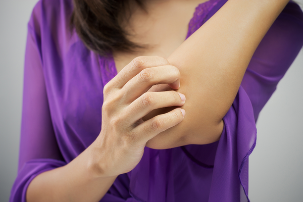 Psoriasis: What is psoriasis?