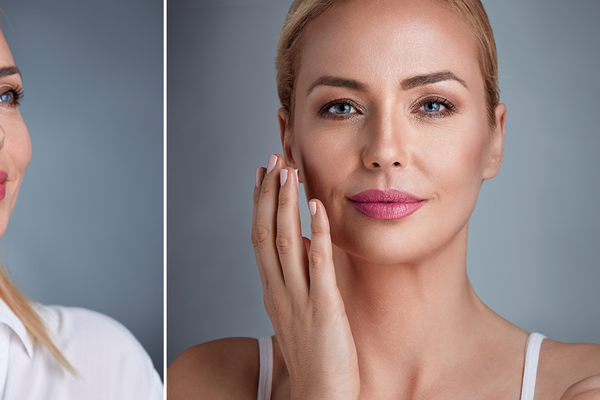Radiant complexion: how to achieve the perfect glow