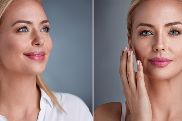 Strahlender Teint: So klappt’s mit dem perfekten Glow