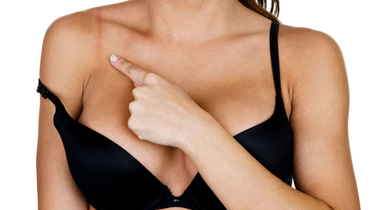 Why women should do without a bra