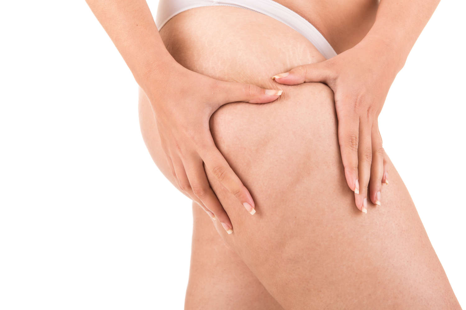 Svagt bindevæv: 3 fødevarer til at bekæmpe cellulite