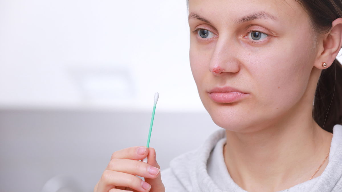 Herpes on the nose: what you can do against the highly contagious viruses