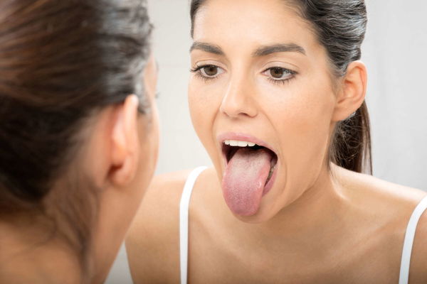 Yellow tongue: What does the yellow coating mean?